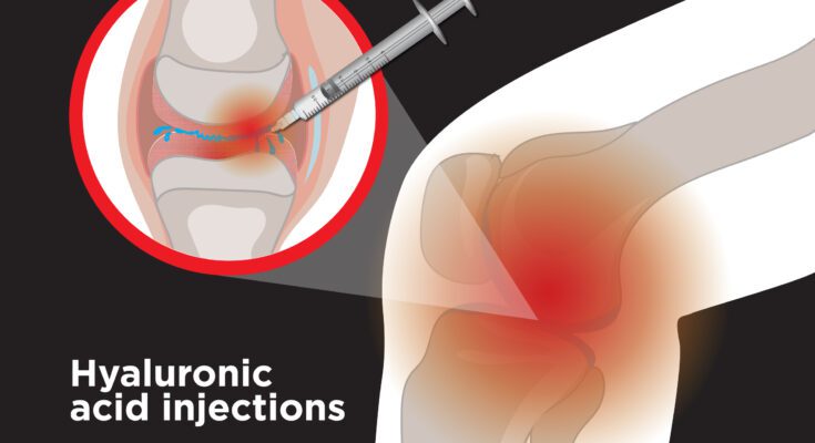 knee gel injections