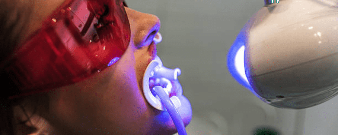 Teeth Whitening Machines