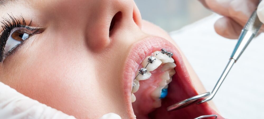 Best Orthodontics Clinic & Dentist in Dubai