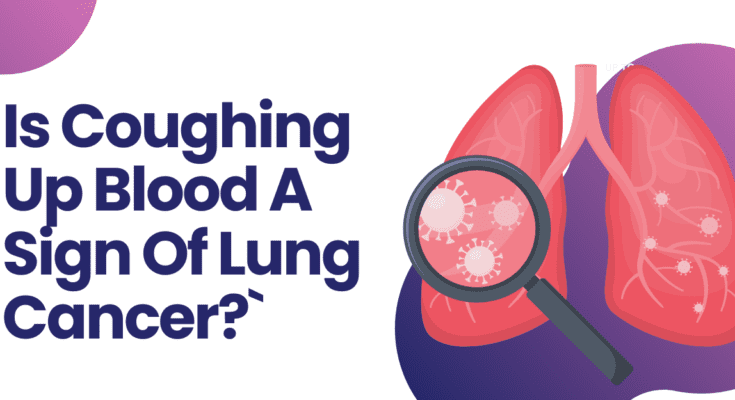 Is Coughing Up Blood A Sign Of Lung Cancer?